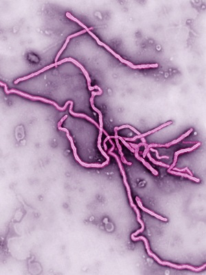 Ebola virus